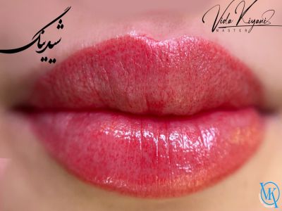 مراقبت های قبل از شیدینگ لب برای گرفتن نتیجه بهتر