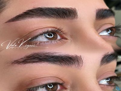 همه چیز درباره میکروبلیدینگ