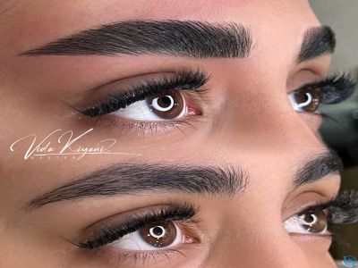 چند روز بعد از ریمو می توان میکروبلیدینگ انجام داد؟ راهنمای کامل و علمی