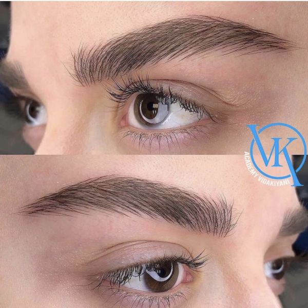 بهترین فیبروز کار ابرو