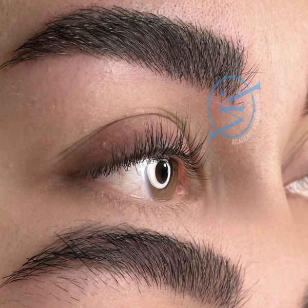 بهترین فیبروز ابرو