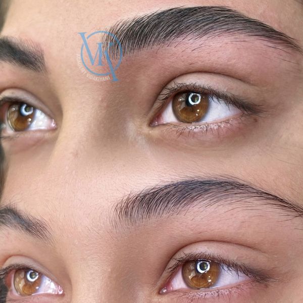 فیبروز طبیعی ویدا کیانی