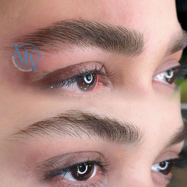 فیبروزسوپرنچرال