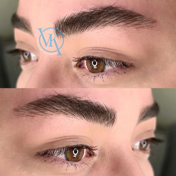 فیبروز طبیعی ابرو