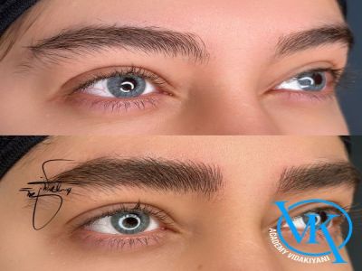 چگونه از تغییر رنگ فیبروز جلوگیری کنیم؟