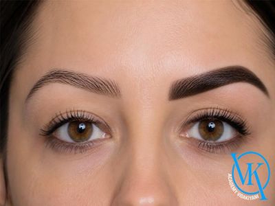تفاوت فیبروز و بولد بروز ابرو + مزایا، معایب و انتخاب بهترین روش
